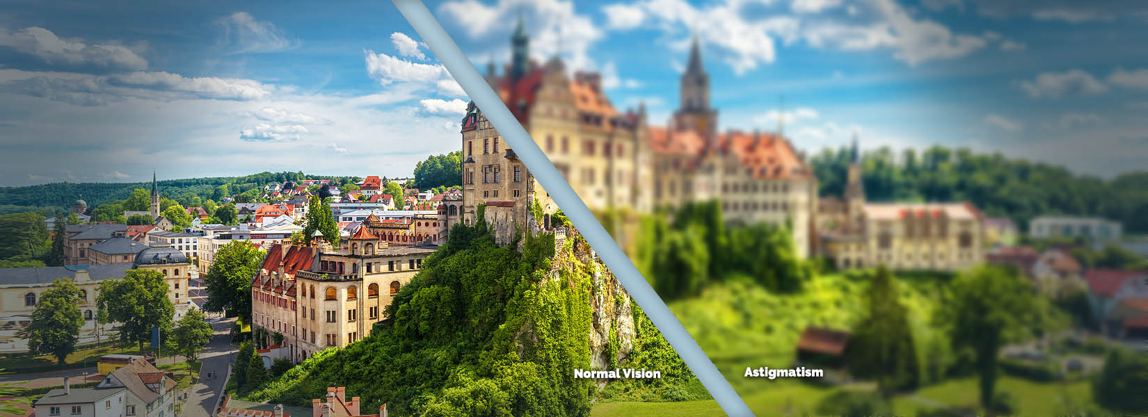 Astigmatism Treatment in Hermitage