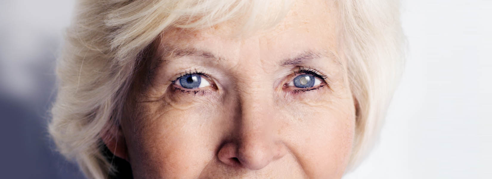 Cataract Surgery in Hermitage